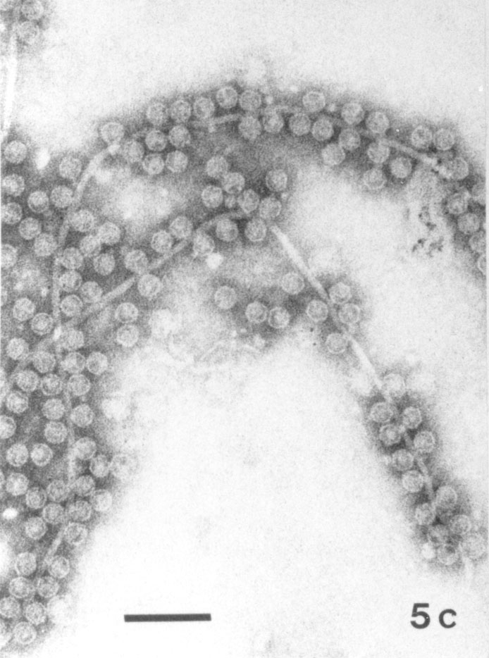 Figure 2-5: Selected isometric and filamentous phages. (a) E. coli microvirus ?X174, x 297,000. (b) Tectivirus 37-64 of Thermus sp., note inner membrane and deformed particles; x 297,000. E. coli levivirus R17 adsorbed to pili, x 148,500. Inovirus H75 of Thermus thermophilus, x 92,400. Bars indicate 100 nm. Uranyl acetate (a) and phosphotungstate (b, c).