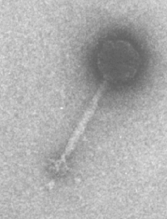 Figure 39-1b: Electron micrographs  of phiC31. (Dr R. Hendrix, Pittsburgh Bacteriophage Institute)