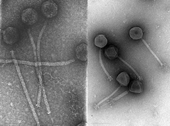 Figure 41-1: Electron micrographs of Lactobacillus casei Siphovirus A2 and Lactobacillus plantarum Myovirus LP65. Note the different scales of the magnification.